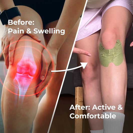 Nurelle Herbal Knee Relief Patches